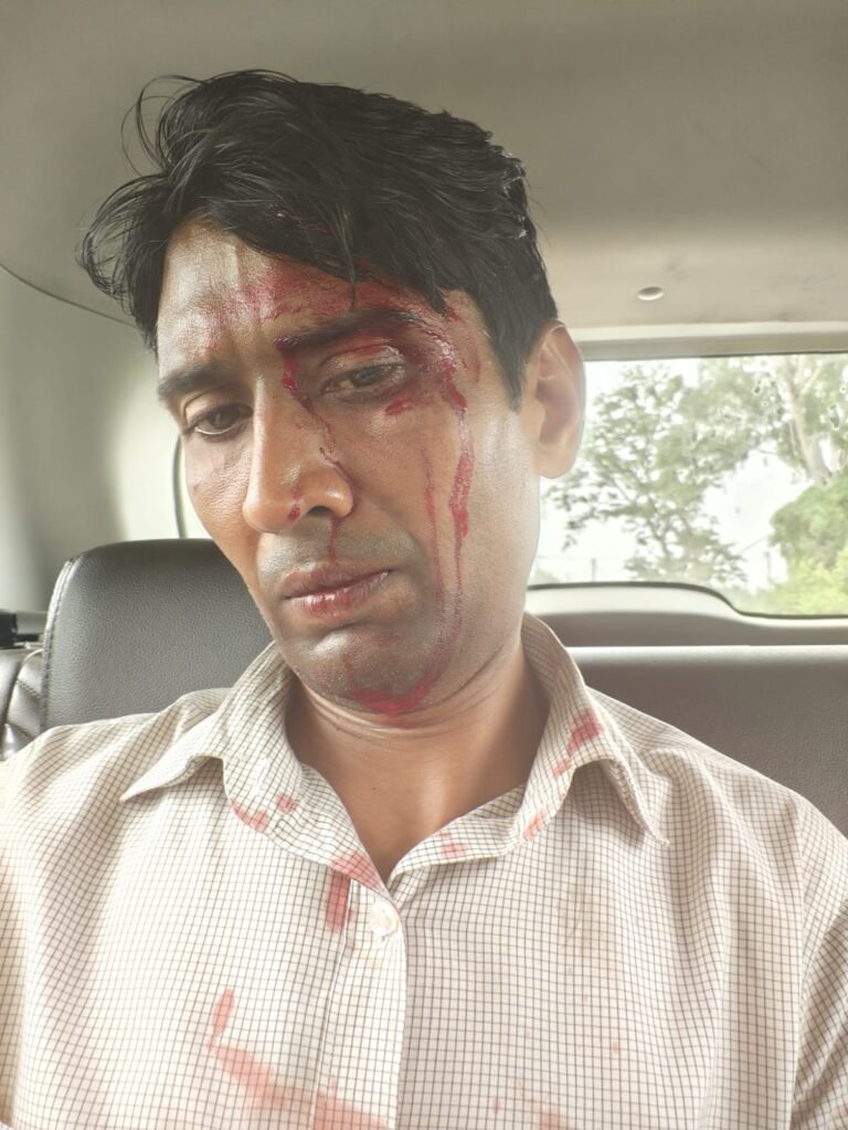 मुजफ्फरनगर में बिजली विभाग के जेई को दौड़ा-दौड़ाकर पीटा, प्रधान पति को हिरासत में लेने पर थाने में हंगामा