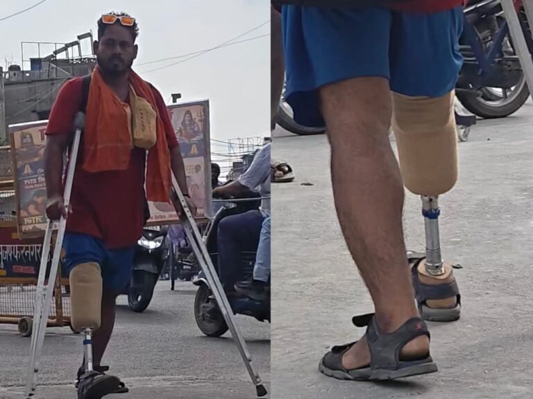 हर कदम पर दर्द… फिर भी नहीं रुका शिवभक्त: आस्था के आगे बेबस हुई मजबूरी! नकली पैर के सहारे पैदल कांवड़ लेकर निकला शिवभक्त, मां के त्याग को समर्पित की कांवड़